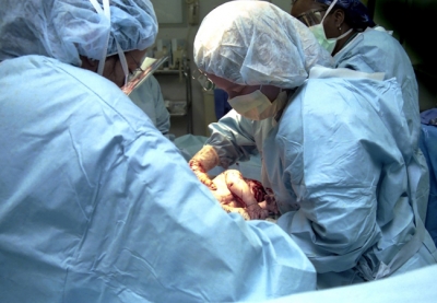 هكذا تؤثّر الولادة القيصرية على دماغ طفلك