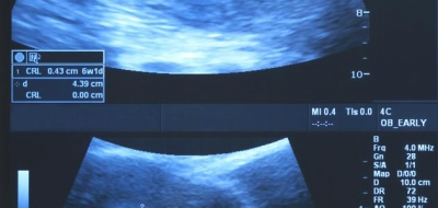 أعراض الحمل في الشهر الأول